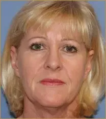 հարսնացուի կրեմ